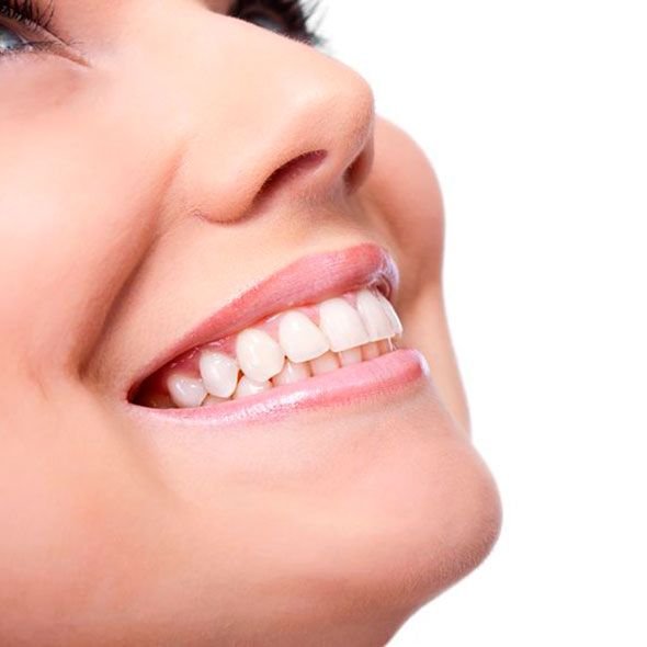 Before and after of a smile makeover